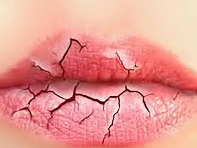 عجیب ترین طالع بینی از شکل لب هایتان / از لب پر تا لب غنچه ای و از لب نازک تا لب های قلبی + عکس و شرح