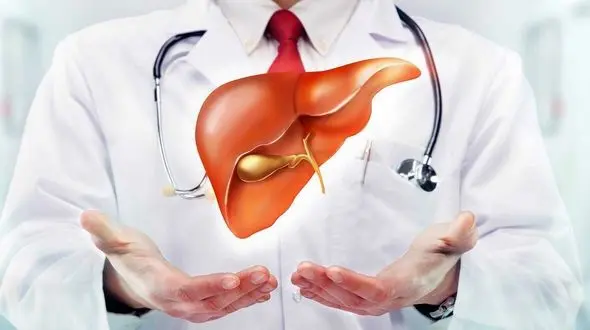 علائم کبد چرب