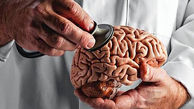 علائم و نشانه های سکته مغزی در بیماران کرونایی 