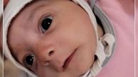 رهاکردن نوزاد دختر 2 ماهه در تبریز / جای جراحی و بخیه روی سر + عکس