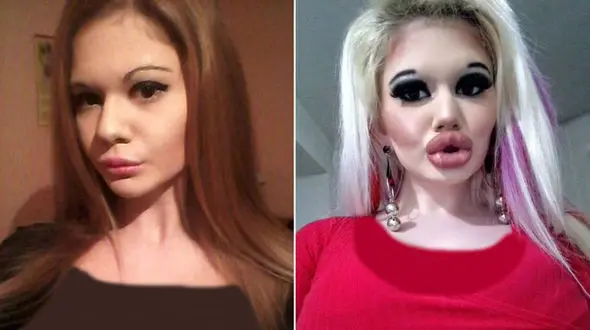 اقدام عجیب دختر دانشجو برای جذب کردن مردان مجرد / او بزرگترین لب دنیا را دارد + عکس