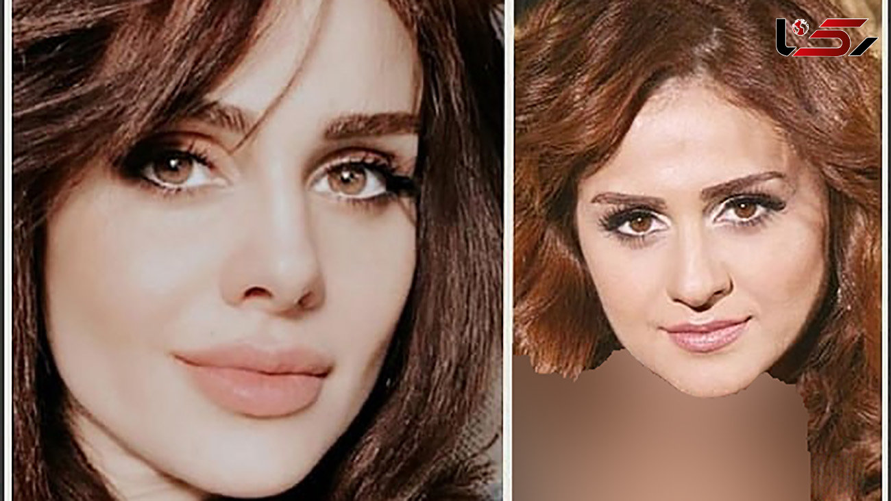 تغییر چهره خواننده معروف زن با عمل بینی + عکس قبل و بعد