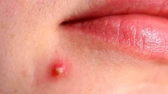 هرجوش صورت چه معنایی دارد؟