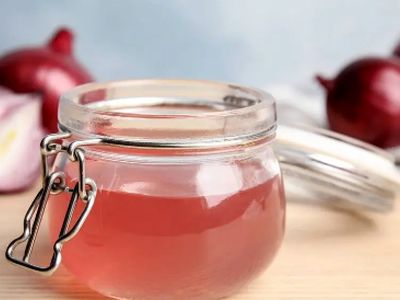 راز داشتن موهای پرپشت و سالم با استفاده از آب پیاز