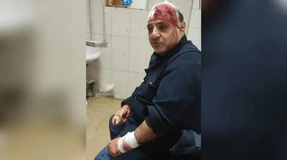 حمله به یک فدراسیون با چاقو و قمه /  مسئولی که به‌خاطر مبارزه با تقلب، خونین و مجروح شد +عکس