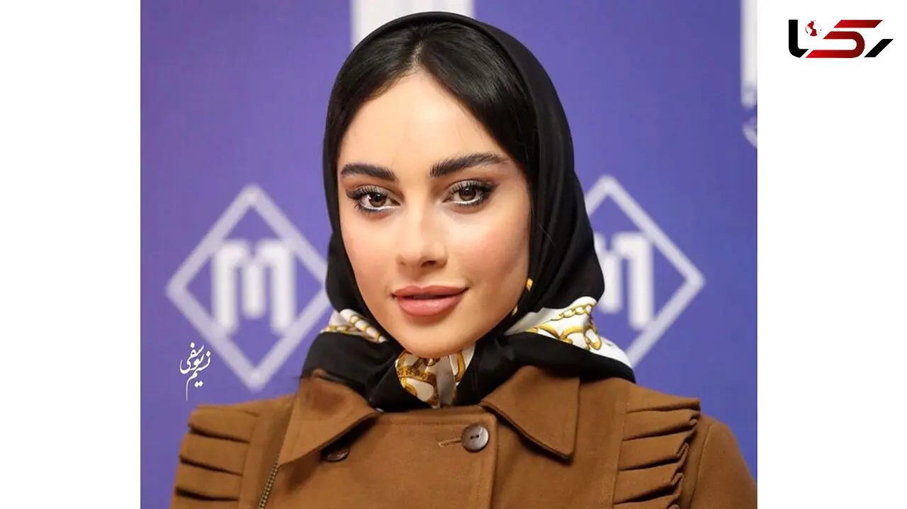 تغییر چهره ترلان پروانه هوادارانش را انگشت به دهان کرد