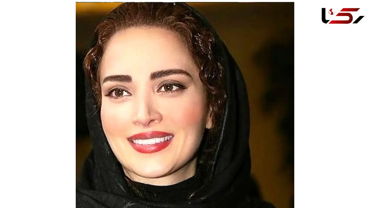 رونمایی بهنوش طباطبایی از چهره جدیدش / خانم بعد از جراحی بینیش کلا یه آدم دیگه شده 