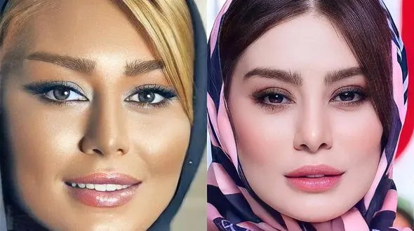 تباه ترین عکس های از خانم بازیگران ایرانی که خود را برنز کردند/ چه بودند و چه شدند!