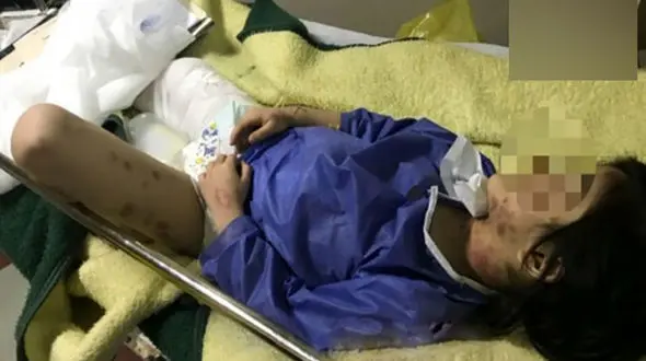 شکنجه وحشیانه دختر 6 ساله توسط مادر سنگدل در مهاباد +عکس