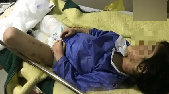 شکنجه وحشیانه دختر 6 ساله توسط مادر سنگدل در مهاباد +عکس