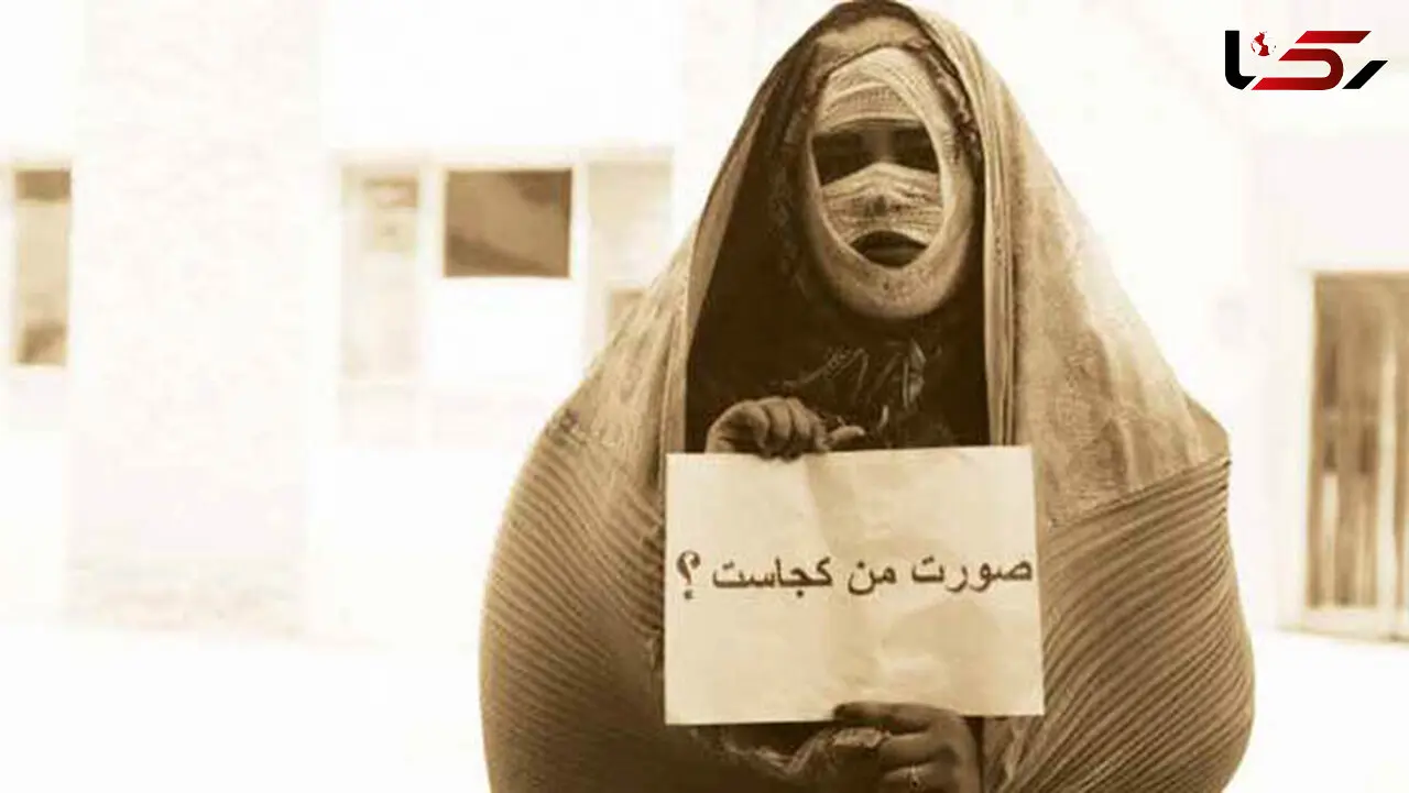 صورت من کجاست؟ / من قربانی خودخواهی های دیگران شده ام! + عکس
