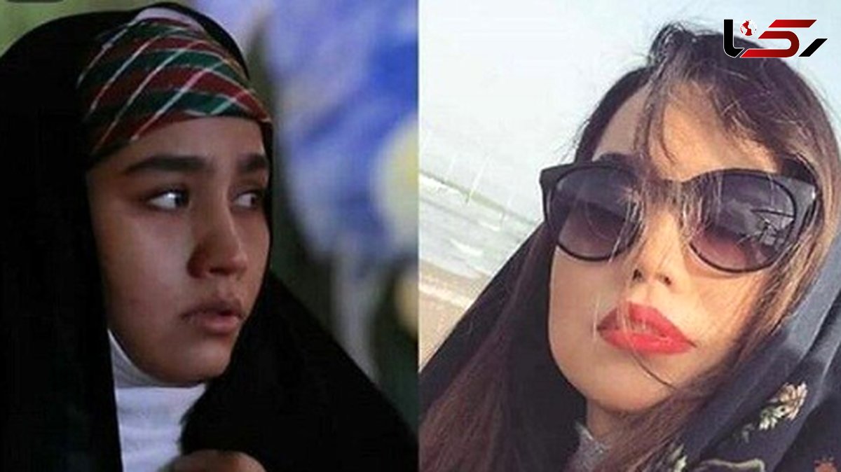 چهره ها/ تغییر چهره «عطیه» سریال بچه مهندس ۳ در ۳۲ سالگی