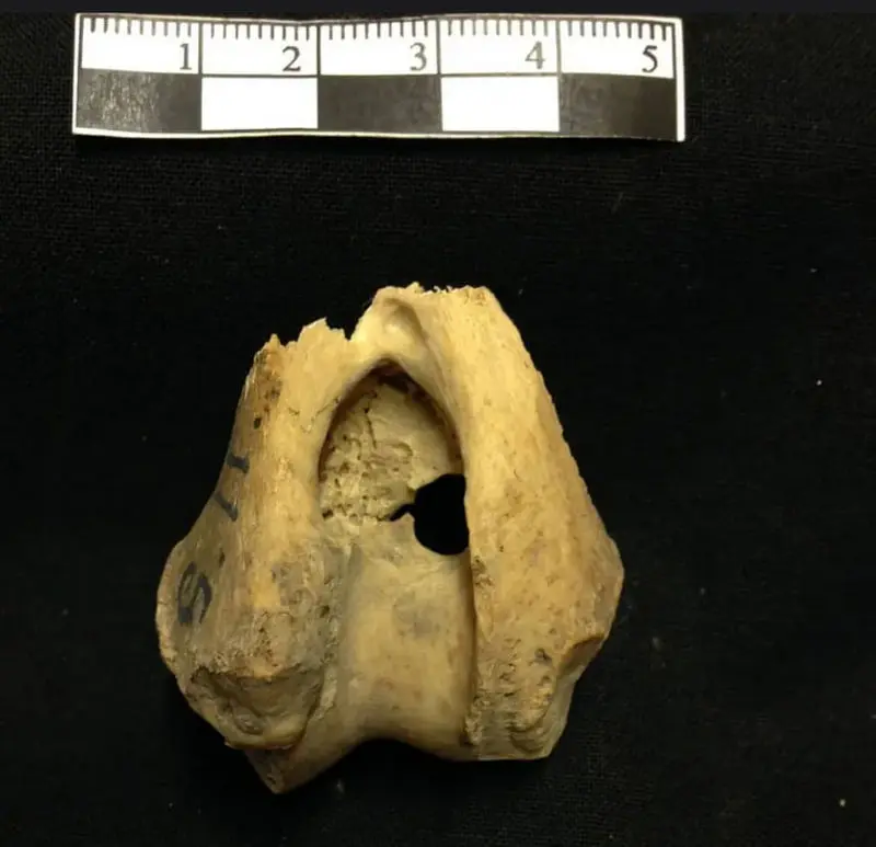 استخوان گرگ