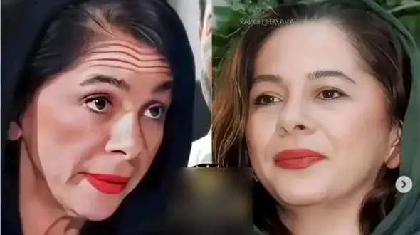 2 بازیگر ایرانی که به خاطر سرطان 20 کیلو وزن کم کردند + عکس ها و اسامی!