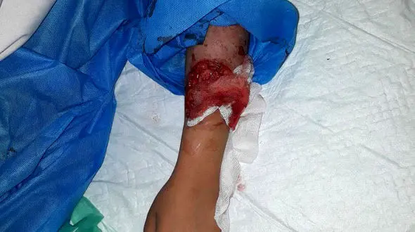 انتشار عکس دختر تهرانی که سگ های شکاری تیکه پاره اش کردند+ جزییات