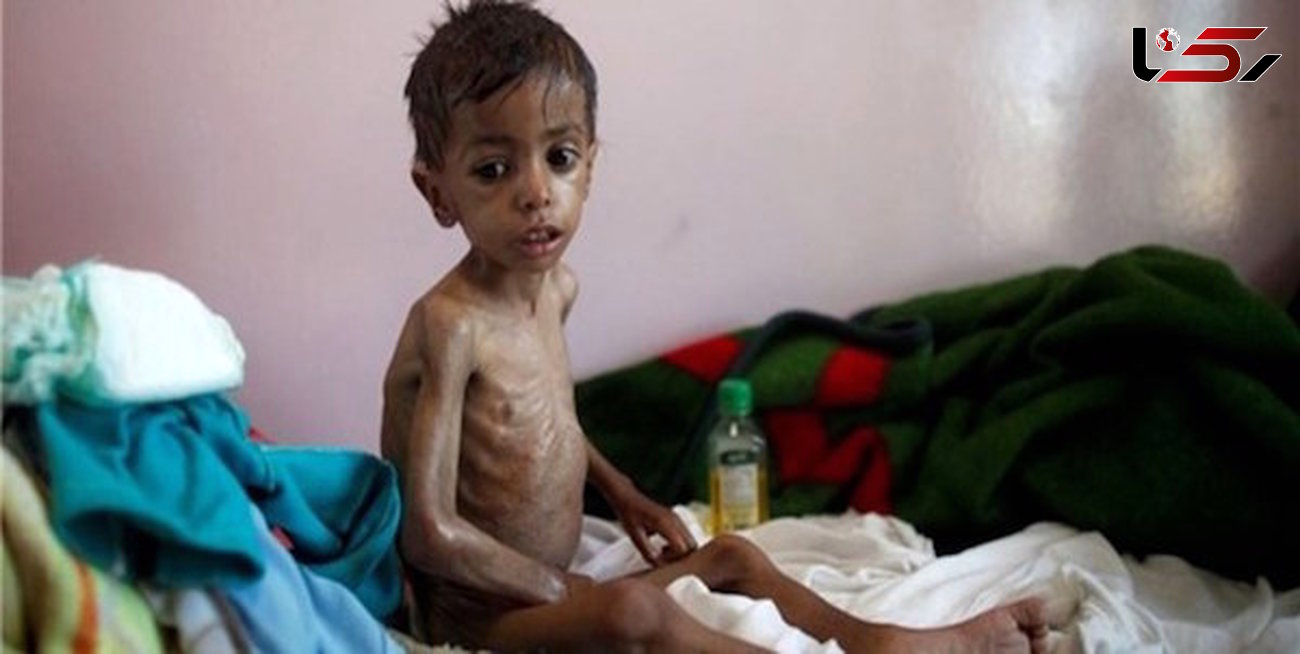 افزایش شمار مبتلایان به وبا در یمن به علت جنگ و محاصره این کشور