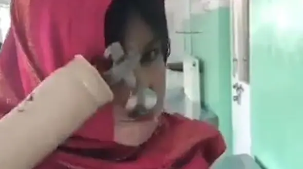 زندگی دوباره یک دختر با ساخت دست مصنوعی + فیلم