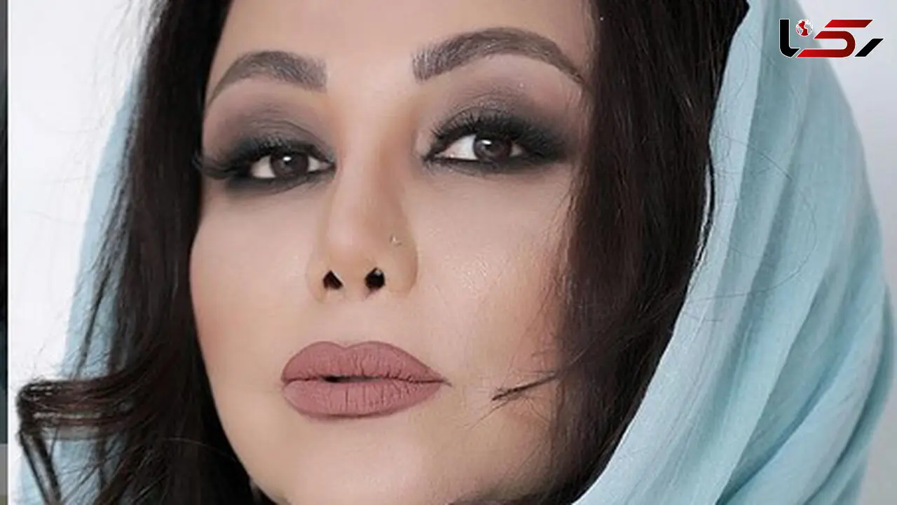 اقدام درست بهنوش بختیاری در عمل بینی اش! +عکس قبل و بعد از عمل