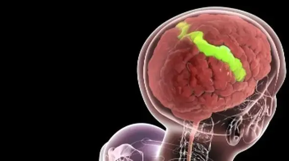 اخبار خوب برای سالمندان: مغز شما قوی‌ تر می‌ شود