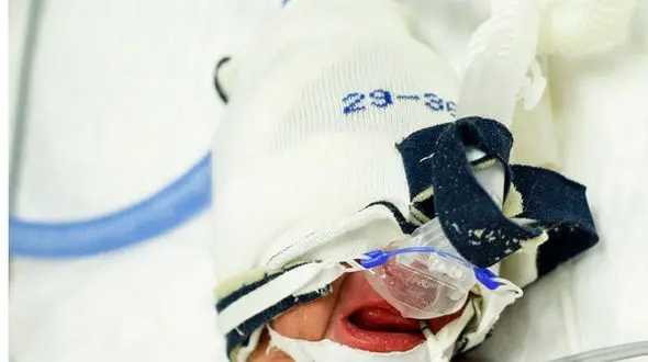 واقعیت وحشتناک /تولد نوزادان نارس در خوزستان / علت چیست؟