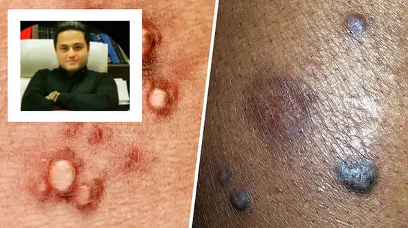 کشف داروی ریشه‌کنی کامل ویروس HPV توسط دانشمند ایرانی / دکتر مهدی والوزی : از مسئولان فقط انتظار حمایت داریم/ کشورهای عربی اعلام پشتیبانی کرده اند!  + فیلم