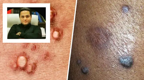 کشف داروی ریشه‌کنی کامل ویروس HPV توسط دانشمند ایرانی / دکتر مهدی والوزی : از مسئولان فقط انتظار حمایت داریم/ کشورهای عربی اعلام پشتیبانی کرده اند!  + فیلم