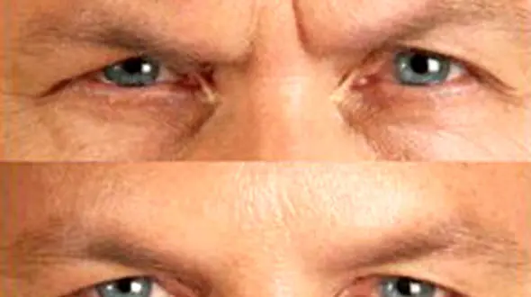 11 پیرکننده انسان را بشناسید!