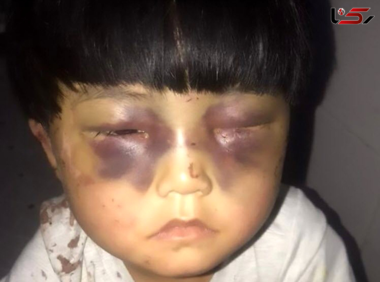 شکنجه وحشتناک دختر خردسال توسط پدرش + عکس 16+