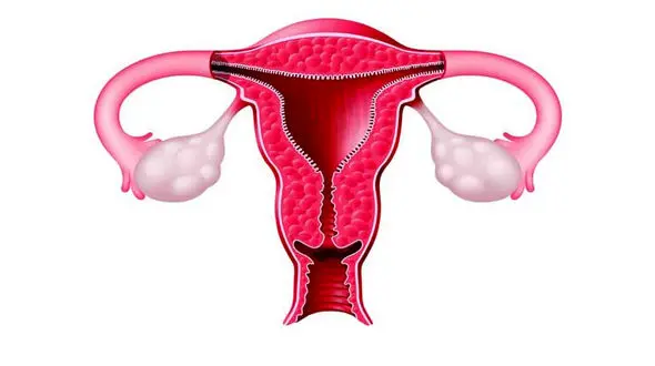 درمان تخمدان با طب سنتی / چند روش ساده‌ 