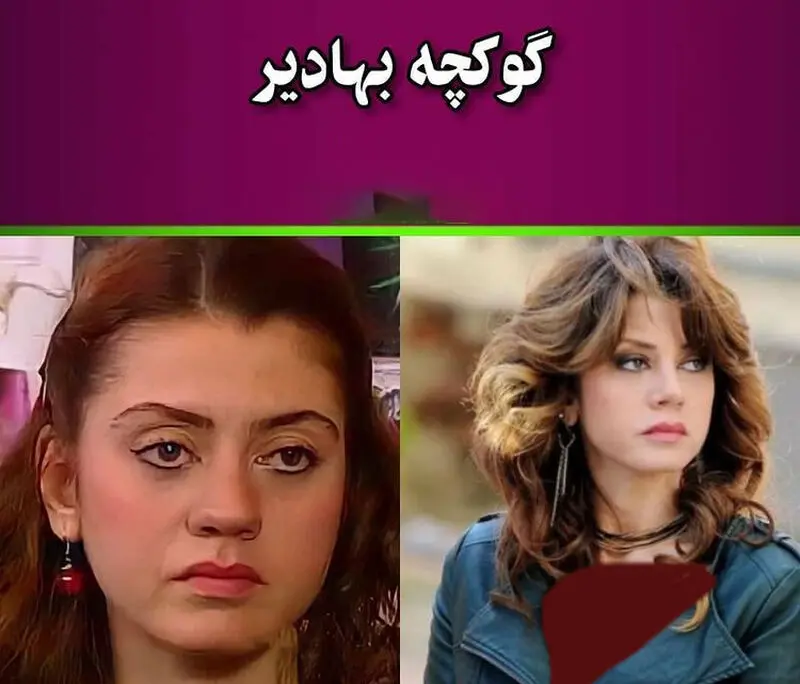 بازیگران قبل و بعد عمل