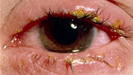 10 دلیل اصلی درد چشم