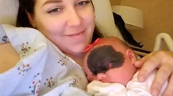 جای بوسه شیطان در چهره نوزاد دختر + عکس 