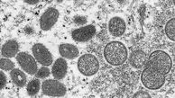 برای اولین بار انستیتو پاستور ایران موفق به تولید شبه ویروس آنفلوآنزای طیور شد