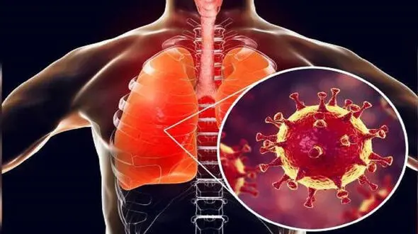 چه بخوریم تا ریه هایمان در دوران کرونا تقویت شود؟ + جدول