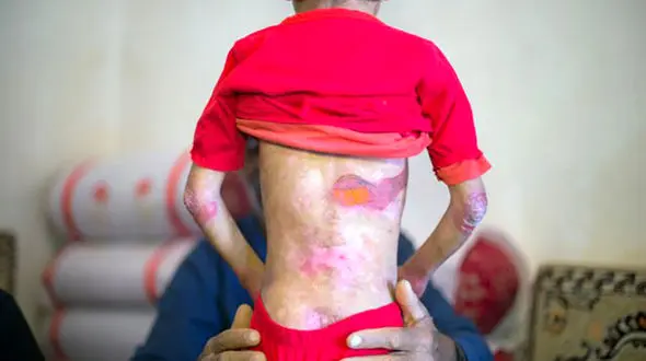 مرگ ۱۵ کودک ایرانی در خانه ای بی ایران + جزییات تلخ