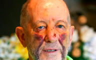 Cancer-survivor, 76, brutally kicked in head six times by thug in random attack