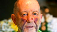 Cancer-survivor, 76, brutally kicked in head six times by thug in random attack