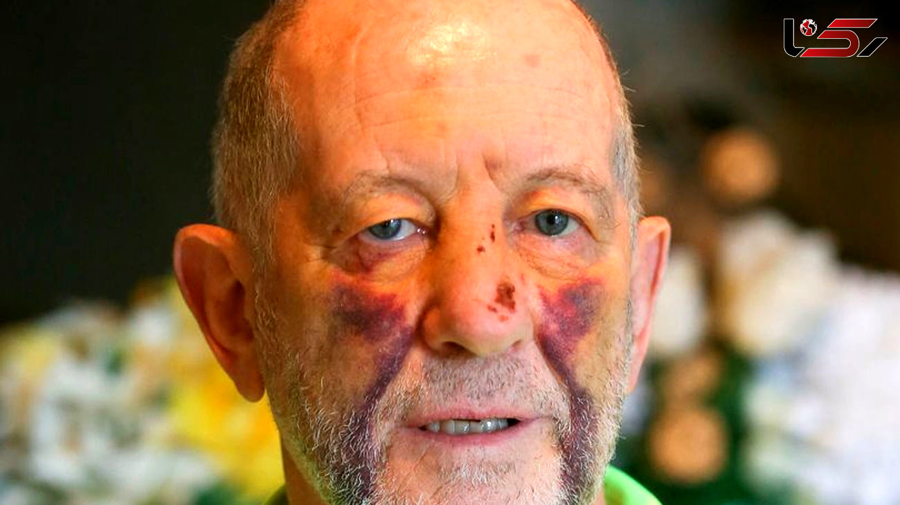 Cancer-survivor, 76, brutally kicked in head six times by thug in random attack