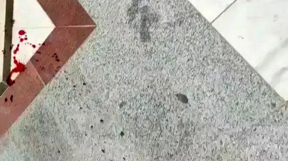 حمله چند شرور به مدیر و معلم مدرسه در بندرعباس / ضربات قمه به گردن مدیر و دست معلم 