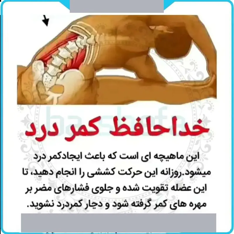 کمردرد
