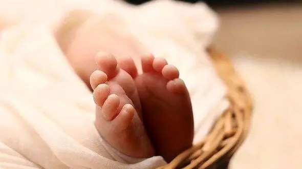 عکس خوشگلترین نوزاد عجیب الخلقه جهان / خنده او دل همه را برد!