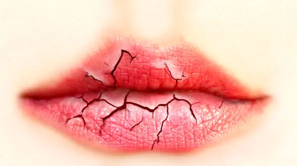 خشکی دهان و ابتلا به هزار و یک بیماری دیگر