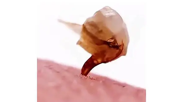 دلیل درد نیش زنبور چیست؟ + فیلم