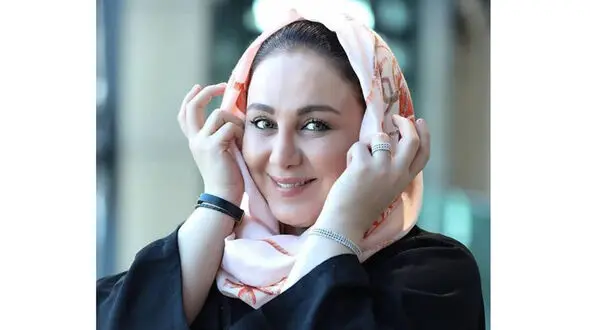 زیبایی جادویی بهنوش بختیاری بعد از عمل ترکیبی صورتش ! / کوبید و ساخت + عکس