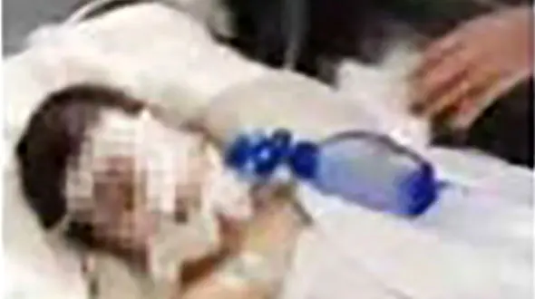 پدر بی رحم به خاطر مشق ننوشتن صورت پسرش را با لوله جاروبرقی ترکاند+عکس