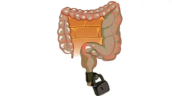 علل مهم یبوست