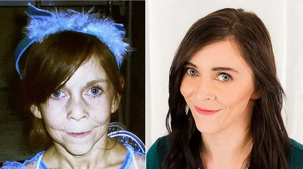 این دختر پیر تنها 20 سال دارد+ عکس