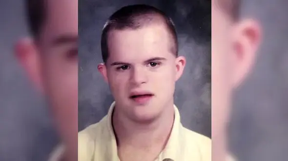 مرگ تلخ بیمار سندروم داون در ماشین+عکس