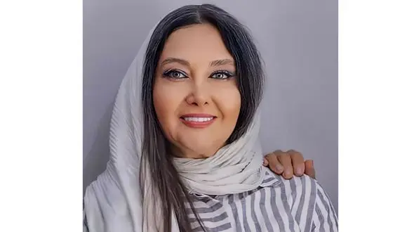 کتایون ریاحی 30 سال جوانتر شد ! + عکس بعد از عمل زیبایی ترکیبی صورت خانم بازیگر !