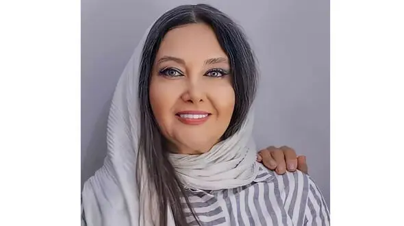 کتایون ریاحی 30 سال جوانتر شد ! + عکس بعد از عمل زیبایی ترکیبی صورت خانم بازیگر !